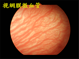 視網膜檢查