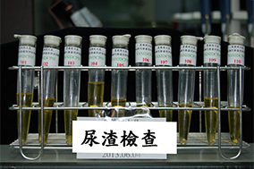 尿液採集及尿渣分析